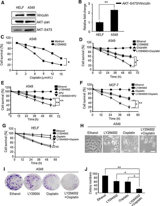 Figure 1. Inhibition of AKT activity sensitized cancer cells to cisplatin-induced cell death. A, Elevated AKT activity in A549 lung cancer cells. B, A statistical analysis of A. C, A growth curve of A549 cells treated with cisplatin and LY294002 (20 μmol/L) for 72 hours. *, P < 0.05 versus the control group. D, A growth curve of A549 cells treated by cisplatin and LY294002 (20 μmol/L) for 72 hours, *, P < 0.05 versus the control group. E, LY294002 improved the sensitivity of A549 cells to 10 μmol/L 5-FU treatment for 72 hours. **, P < 0.01 versus the control group. A growth curve of MCF7 (F) and HELF (G) cells treated with cisplatin (7.5 μmol/L) and LY294002 (20 μmol/L) for 72 hours. Suppression of AKT activity sensitized cancer cells to cisplatin. All of the above data represent mean ± SD from three independent assays. *, P < 0.05, **, P < 0.01 versus the control group. H, Cell morphology of A549 lung cancer cells treated with cisplatin (7.5 μmol/L) and LY294002 (20 μmol/L) for 48 hours. Scale bar, 50 μm. I, Representative images for colony formation assay. J, A statistical analysis of I. *, P < 0.05, **, P < 0.01 versus the control group. NS, no significant differences.