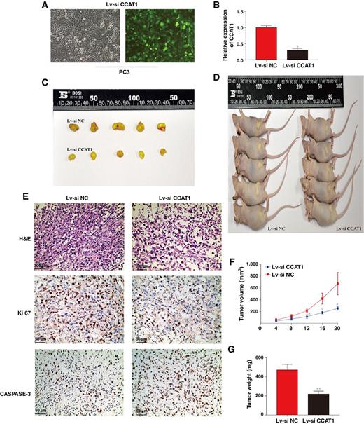Figure 3. Reduction in CCAT1 suppresses the formation of prostate xenograft tumors in vivo. A, Fluorescence microscopy was used for the detection of transfection efficiency for LV-anti-CCAT1 transfection, and the results showed that efficiencies were all greater than 90%. B, Expression of CCAT1 was measured by qRT-PCR in PC3 cells transfected with Lv-anti-CCAT1 vector, which were then implanted into nude mice. C and D, Subcutaneous tumors that formed in nude mice using stably transfected PC3 cells showed inhibition of CCAT1 or controls at 20 days (n = 5/group). E, H&E and IHC staining of Ki67, activated CASPASE-3 in the endpoint tumors revealed that significantly reduced Ki67-positive cells and increased CASPASE-3–positive cells in CCAT1 downregulated PC3 tumors. Scale bars represent 50 and 100 μm. Each bar represents the mean ± SD of three independent experiments. *, P < 0.05. F, Tumor formation growth curves after transfection with indicated cells. G, Histograms describing the mean tumor weights of each group. Mean tumor volumes are plotted.