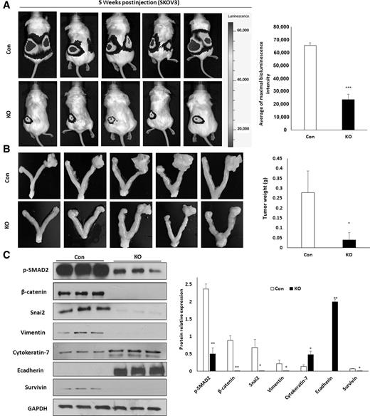 Figure 1. KO of survivin inhibits primary ovarian tumor growth in an orthotopic ovarian cancer mouse model. A, Live animal imaging of primary tumors in ovaries of mice at 1 month following intrabursally injecting SKOV3 survivin-KO and control (Con) cells (***, P < 0.001; n = 5). B, Tumors in ovaries of mice were dissected and imaged (*, P < 0.05; n = 5). C, Western blot analysis and comparison of survivin, pSMAD2, and EMT markers in primary ovarian tumors from three different xenografted mice (*, P < 0.05; **, P < 0.01).