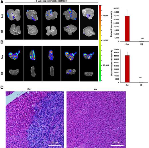 Figure 2. KO of survivin inhibits ovarian tumor metastasis in an orthotopic ovarian cancer mouse model. Metastatic tumors in liver (A) and spleen (B) of xenografted mice were identified by live animal imaging. The maximal bioluminescence intensity was compared between control (Con) and survivin-KO mice (***, P < 0.001; n = 5). C, H&E staining of metastatic tumors in livers of xenografted mice.