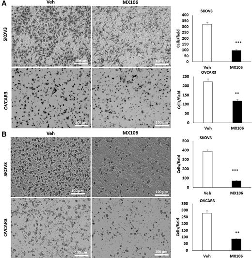 Figure 5. MX106 inhibits ovarian cell migration and invasion. A, Cell migration in SKOV3 or OVCAR3 cells was examined using transwell plates following 5 μmol/L MX106 treatment for 4 hours, and migrated cells were stained with crystal blue and counted (**, P < 0.01; ***, P < 0.001). B, Cell invasion in SKOV3 or OVCAR3 cells following 5 μmol/L MX106 treatment was examined using Matrigel-coated plates, and invaded cells were stained with H&E and counted (**, P < 0.01; ***, P < 0.001). Veh, vehicle.