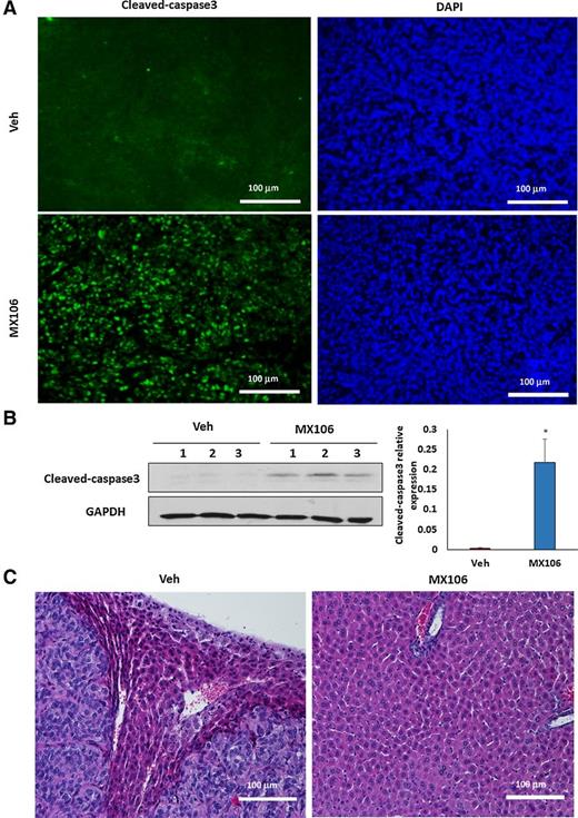Figure 8. MX106 inhibits ovarian tumor metastasis and induced cell apoptosis in an orthotopic ovarian cancer mouse model. A, Ovarian tumor sections were immunostained using cleaved-caspase3 antibody following MX106 or vehicle (Veh) treatment. B, Cell apoptosis in ovaries was detected and compared by examining cleaved-caspase3 using Western blot analysis in primary ovarian tumors from three different xenografted mice (*, P < 0.05). C, H&E–stained metastatic ovarian tumor in liver following MX106 or vehicle treatment.