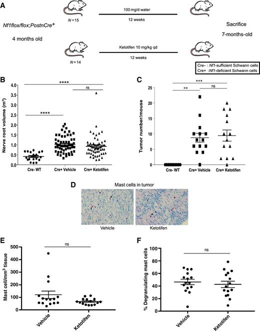 Figure 2. Ketotifen fails to inhibit established neurofibroma progression in Nf1-deficient mice. A, Schematic of experimental design of established tumor regression study. B, Proximal nerve root volume in water/vehicle and ketotifen-treated Nf1flox/flox;PostnCre+ mice (P > 0.05, ns) and in WT Nf1flox/flox;PostnCre- mice (water/vehicle-treated vs. WT ****, P < 0.0001; ketotifen-treated vs. WT ****, P < 0.0001). C, Quantitation of tumors in water/vehicle and ketotifen-treated Nf1flox/flox;PostnCre+ mice (P > 0.05, ns) and in WT Nf1flox/flox;PostnCre- mice (water/vehicle-treated vs. WT **, P = 0.0010; ketotifen-treated vs. WT ***, P = 0.0004). D, Histological analysis of toluidine blue-stained tumor tissue from water/vehicle- and ketotifen-treated Nf1flox/flox;PostnCre+ mice. Images were obtained using a ×40 objective lens. Black arrows point to representative infiltrating mast cells. Red arrows point to representative degranulating mast cells. E, Quantitation of mast cell infiltration in water/vehicle- and ketotifen-treated Nf1flox/flox;PostnCre+ mice (P = 0.0821, ns). F, Quantitation of the percentage of degranulating mast cells in water/vehicle and ketotifen-treated Nf1flox/flox;PostnCre+ mice (P = 0.5686, ns).
