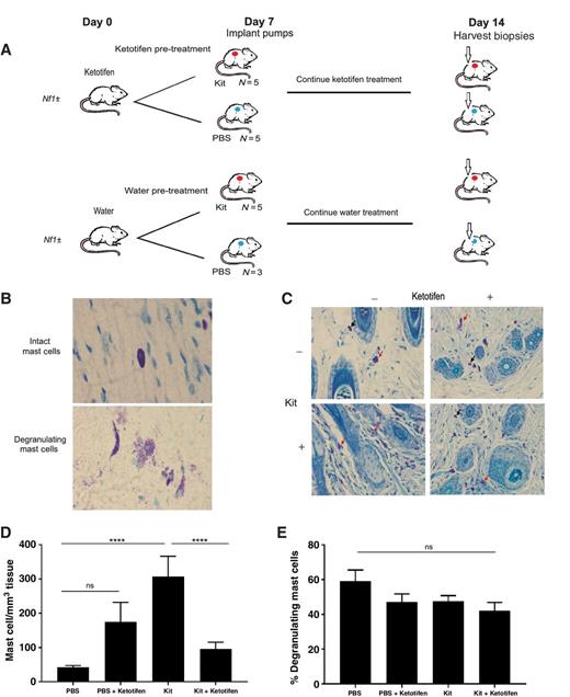Figure 3. Effect of Ketotifen on Kit-mediated mast cell infiltration and degranulation in vivo. A, Schematic of experimental design in ketotifen-pretreated/treated Nf1+/− mice with continuous Kit ligand or PBS subcutaneous infusion. B, Histological analysis demonstrating toluidine blue-stained intact versus degranulating mast cells in the skin following a 7 day Kit or PBS infusion. Image obtained using a ×100 objective lens with oil. C, Histological analysis of toluidine blue-stained skin biopsy of 20 μg/kg/d Kit ligand infusion-mediated and PBS infusion-mediated mast cell infiltration in ketotifen-treated and water/vehicle-treated 4-month-old Nf1+/− mice. Images were obtained using a ×40 objective lens. Black arrows point to representative infiltrating mast cells. Red arrows point to representative degranulating mast cells. D, Quantification of toluidine blue-stained skin biopsy of 20 μg/kg/d Kit ligand infusion-mediated and PBS infusion-mediated mast cell infiltration per high-powered field in ketotifen-treated and water vehicle 4-month old Nf1+/− mice (for PBS pump vs. Kit ligand pump, ****, P < 0.0001; for PBS pump vs. ketotifen-treated PBS pump, P > 0.05, ns; for Kit ligand pump vs. ketotifen-treated Kit ligand pump, ****, P <0.0001). E, Quantitation of toluidine blue-stained skin biopsy of 20 μg/kg/d Kit ligand infusion-mediated and PBS infusion-mediated absolute number degranulating mast cells per high-powered field (for PBS pump vs. Kit ligand pump, P > 0.05, ns; for PBS pump vs. ketotifen-treated PBS pump, P > 0.05, ns; for Kit ligand pump vs. ketotifen-treated Kit ligand pump, P > 0.05, ns).