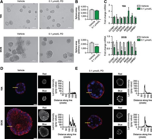 Figure 2. Palbociclib (PD) treatment in 3D. PD selectively influences MCFDCIS spheres in 3D culture, normalizing their architecture. A, MCF10A (top) and MCFDCIS (bottom) spheres grown in 3D in the presence of vehicle or 0.1 μmol/L PD. ×20 magnification, scale, 200 μm. B, Quantification of A; sphere areas calculated using Fiji software. Mean ± SEM (Student t test, ****P < 0.0001 relative to vehicle). C, qPCR analysis of cell-cycle/senescence-regulated mRNA targets in MCF10A (top) and MCFDCIS (bottom) spheres treated with PD as indicated. Mean fold change ± SEM (Student t test, **P < 0.01, ***P < 0.001, ****P < 0.0001 relative to vehicle). D, Vehicle-treated MCF10A (top) and MCFDCIS (bottom) spheres stained for LAMININ 5 (red) and DAPI (blue) along with quantification of the distribution of LAMININ 5 signal intensity measured along the yellow line indicated in the photos. ×63 magnification, scale, 25 μm. E, PD-treated MCF10A (top) and MCFDCIS (bottom) spheres stained for LAMININ 5 (red) and DAPI (blue) along with quantification of the distribution of LAMININ 5 signal intensity measured along the yellow line indicated. ×63 magnification, scale, 25 μm.