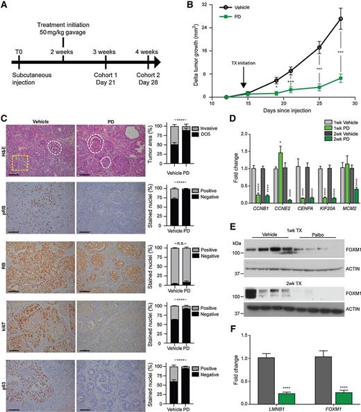 Figure 3. Palbociclib (PD) treatment in vivo. PD delays growth and progression of MCFDCIS xenograft tumors in nude mice. A, Schematic of experimental design and time points. B, Tumor growth curves for vehicle- or PD-treated MCFDCIS tumors following subcutaneous injection of cells, represented as the change (delta) in tumor size normalized to initial tumor size (2-way ANOVA and Bonferroni posttests, *P < 0.05, **P < 0.01, ***P < 0.001, ****P < 0.0001 relative to vehicle). C, Cohort 2 tumor sections stained with hematoxylin and eosin as well as IHC for phosphorylated RB (S807/811), total RB, KI67, and P63, treated with PD as indicated and associated quantifications (chi-square tests, ****P < 0.0001, ×20 magnication, scale, 100 μm). D, qPCR analysis of cell-cycle regulated mRNA targets in MCFDCIS tumors treated with PD as indicated. Mean fold change ± SEM (Student t test, **P < 0.01, ***P < 0.001, ****P < 0.0001 relative to vehicle). E, Western blot analysis for expression of FOXM1 and actin in tumor lysates at both 1 and 2 weeks of treatment with PD as indicated. F, qPCR analysis of senescence-regulated mRNA targets in MCFDCIS tumors treated with PD as indicated. Mean fold change ± SEM (Student t test, ****P < 0.0001 relative to vehicle). n.s., not significant.