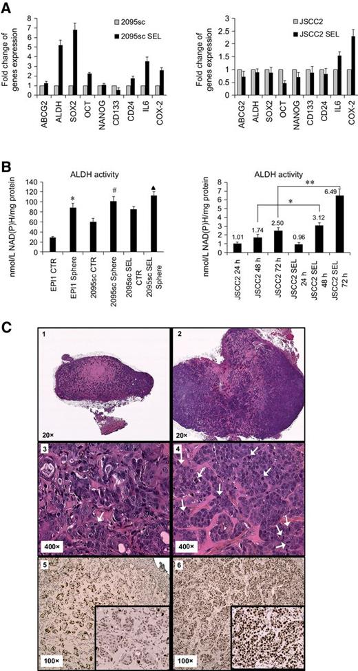 Figure 1. Paclitaxel challenge followed by tumorsphere selection × 3 generated CSCE cultures as shown by altered gene expression (A), enhanced ALDH function (B), and greater proliferative potential in vivo (C). A, Our data show cancer stem cell enrichment altered gene expression toward stem cell proteins (2095sc SEL) and protumorigenic proteins (2095sc SEL, JSCC2 SEL; data expressed as fold change relative to levels of gene expression in control, parent cultures, n = 3 for all groups). B, ALDH function significantly increased during conditions that increased stem cells, including tumorsphere cell suspensions and following paclitaxel-tumorsphere selection (n = 5 for all groups, P < 0.05). Further, stem cell–enriched SEL cultures possessed increased ALDH functional activity during log growth (B) and also showed the capacity to rapidly increase function over time (approximately 2.6-fold greater at 72-hour assessment) in accordance with greater culture confluence (n = 3 for all groups, P < 0.05 48-hour control relative to 48-hour SEL, P < 0.01 72-hour control relative to 72-hour SEL). High ALDH activity generates abundant reduced nicotinamide adenine dinucleotides [NAD(P)H], which in turn provide reducing equivalents essential for mitochondrial ATP synthesis, biosynthesis of lipids and deoxynucleotides, detoxification of aldehydes, cytoprotective enzymes (e.g., glutathione peroxidase), and facilitate cell proliferation. C1–6, 1 × 106 log growth 2095sc cells (control) and 1 × 106 CSCE 2095sc cells were placed in 100 μL Matrigel and injected into the flanks of nude mice. Every mouse contained both a control culture and SEL culture injection. Measurements were obtained daily (length × width), and mice were euthanized 14 days after 2095sc ±SEL injections. Nine of 10 and 8 of 10 mice formed OSCC xenografts from the SEL and control cells, respectively. 1 and 2, Although SEL tumors were larger at harvest, these differences were not statistically significant upon tumor size measurement with microscopy. 2 and 3, Representative images depict isolated OSCC xenograft tumors. The tumor nests appear as dark blue islands contained within the connective tissue stroma (3 = control tumor, 4 = SEL tumor, 20× image scale). Investigator-blinded quantification of tumor cell mitotic figures revealed significantly higher mitotic activity in the SEL tumors (white arrows depict mitotic figures; P = 0.0114, n = 10 each group, unpaired t test). 5 (control) and 6 (SEL), Monoclonal Ki67 IHC staining intensity (Cell Signaling Technology, 1:400, Cat#9027; Clone#D2H10) was quantitatively analyzed using Image-Pro Premier software (Media Cybernetics). Ki-67 IHC staining also revealed significantly greater cell-cycle activity in the SEL xenografts (5 and 6, 100× image scale, P < 0.0499). Inset lower right corner depicts a higher image scale (200×) of Ki-67 staining in the control and SEL tumors, respectively.