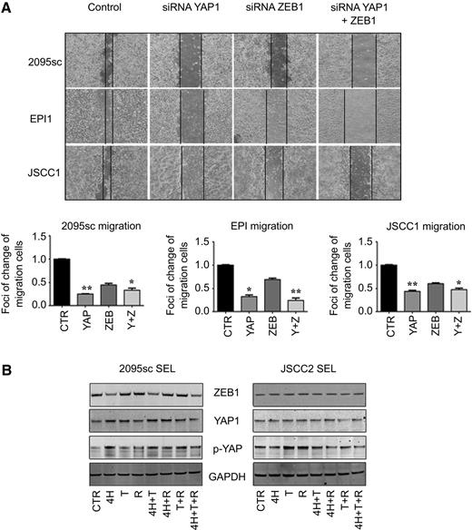 Figure 5. ZEB1 and YAP are integral for directed migration in OSCC cells lines, and the selected chemopreventives reduce levels of these key EMT-enabling proteins in the 2095sc SEL line. A, Although siRNA appreciably reduced cell levels of YAP1 and ZEB1 (see Supplementary Fig. S5), siRNA reduction of YAP1 and a combination of siRA reduction of YAP1-ZEB1 significantly inhibited directed cell migration in all three highly mobile cell lines (n = 5 every group: *, P < 0.05 and **, P < 0.01). B, Individual and combined chemopreventive treatments with fenretinide (4H, 5 μmol/L), tocilizumab (T, 1 μg/mL), and reparixin (R, 10 μmol/L) modestly reduced levels of ZEB1 and increased levels of the inactive p-YAP in the 2095sc SEL cells. Protein levels of the JSCC2 SEL line were relatively refractory to treatment.