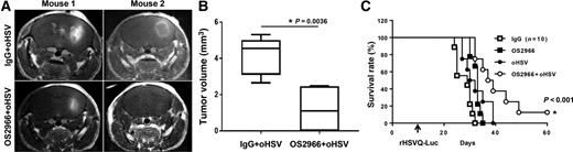 Figure 5. Combination treatment with oHSV and S2966 enhances survival of patient-derived primary GBM (GBM12)-bearing mice in vivo. A–C, Athymic nude mice bearing intracranial patient-derived primary GBM12 tumors were treated with control IgG or OS2966 (5 mg/kg) intratumorally twice a week for 1 month. oHSV were injected by IT injection on day 10 after tumor implantation, and mice were then monitored for survival. A, T1-weighted MRI images of coronal sections of tumor-bearing mice 3 days post-oHSV treatment (13 days post-tumor implantation). B, The volume of tumor measured on MRI. C, Data shown are Kaplan–Meier survival curves of animals in each group (n = 8 for IgG, OS2966, and oHSV+IgG, and oHSV+OS2966). Mice were euthanized when they showed symptoms of hunched posture, rough coat, thin body, or limb paralysis.