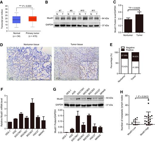 Figure 1. Mus81 expression is elevated in gastric cancer and associated with lymph node metastasis. A, Expression of Mus81 in gastric cancer tissues and normal tissues from the analysis of the TCGA database (t test). B, Western blots of Mus81 protein expression in gastric cancer patient specimens (N, nontumor tissue; T, tumor tissue). C, Quantification of western blots as in B and data are presented as the mean ± SD (t test). D, Representative images of IHC Mus81 staining in gastric cancer and adjacent tissues from patient specimens. E, Frequency of Mus81-negative and -positive IHC staining in normal and gastric cancer tissues from patient specimens (n = 29). qPCR analysis of mRNA expression levels (F) and Western blot analysis of protein (G) expression levels of Mus81 in a gastric normal epithelial cell line (GES-1) and 6 indicated gastric cancer cell lines. H, Correlation between Mus81 expression and the number of metastatic lymph node in 29 patients with gastric cancer (t test; *, P < 0.05; **, P < 0.01).