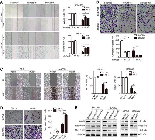 Figure 2. Mus81 promotes gastric cancer cell migration by regulating EMT in vitro. A and B, Cell migration analyses by using wound healing (A) and Transwell (B) assays were performed in Mus81-depleted SGC7901 and BGC823 cells. Data are reported as the mean ± SD of three independent experiments (t test). C and D, Cell migration analyses were performed in Mus81-overexpressing GES-1 cells and MGC803 cells after transfecting with the Mus81 overexpression vector. Data are presented as the mean ± SD (t test). E, Western blots showing that the expression of E-cadherin and N-cadherin in Mus81-depleted or -overexpressing gastric cancer cells (*, P < 0.05; **, P < 0.01).