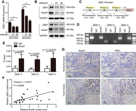 Figure 3. Mus81 regulates ZEB1 gene expression in gastric cancer. A, qPCR analysis of ZEB1 mRNA level in Mus81-depleted gastric cancer cells. Data are reported as mean ± SD of three independent experiments (t test). B, Western blots of ZEB1 expression in Mus81-depleted gastric cancer cells. C, Diagram of ZEB1 primers used for ChIP assays. D and E, ChIP-qPCR was used to evaluate of Mus81 enrichment at the promoter region of ZEB1. Representative agarose gel image of DNA fragments amplified in the ChIP assays (D); qPCR analysis of ChIP assays (E). Data presented as the mean ± SD of three independent experiments (t test). F, Pearson correlation analysis to determine the correlation between Mus81 and ZEB1 expression in patients with gastric cancer (n = 29). G, Representative images of IHC staining of Mus81 and ZEB1 in gastric cancer and adjacent tissues (n = 29; *, P < 0.05; **, P < 0.01; ns, not significant).