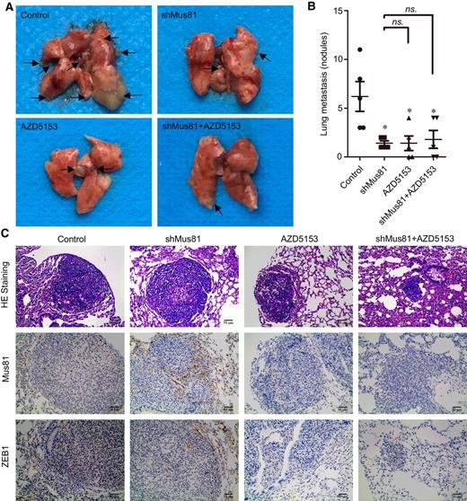 Figure 7. The BRD4 inhibitor AZD5153 decreases gastric cancer cells metastasis via targeting Mus81 in vivo. A, Images of nude mice lung metastases (arrows point to the metastasis nodules). B, Quantification of the nodules in the control, Mus81-depleted, AZD5153-treated, and Mus81-depleted plus AZD5153-treated groups, presented as the mean ± SD (n = 5, t test). C, H&E staining of lung nodules in the control, Mus81-depleted, AZD5153-treated, and Mus81-depleted plus AZD5153-treated mice. IHC staining was used to determine the expression of Mus81 and ZEB1 in the control, Mus81-depleted, AZD5153-treated, and Mus81-depleted plus AZD5153-treated mice (*, P < 0.05; ns., not significant).