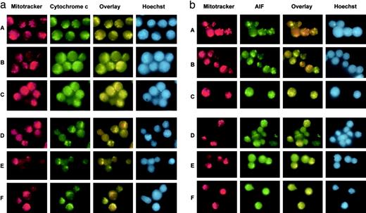 Fig. 4. Effect of As2O3 on the release of cytochrome c and AIF. The effect of As2O3 on release of cytochrome c (a) and AIF (b). In a and b, A shows MNCs alone, B shows MNCs transfected with control plasmid, C shows MNCs transfected with Bcl-2 expression plasmid, D is MNCs stimulated with As2O3, E shows MNCs transfected with control plasmid and activated with As2O3, and F is MNCs transfected with Bcl-2 expression plasmid and activated with As2O3. Overlay is of Mitotracker (red) and cytochrome c or AIF (green). Hoechst 33258 dye is used to examine chromatin fragmentation.