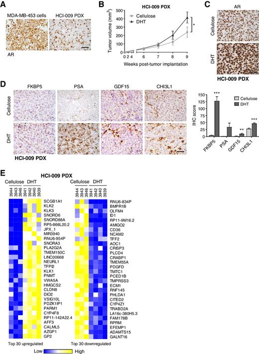 Figure 2. Androgen-responsive TNBC PDX model. A, TNBC PDX HCI-009 was propagated in NSG mice. Tumor tissue was stained for AR by IHC. AR staining in MDA-MB-453 cells is shown for comparison. B–E, HCI-009 PDX tumor portions were injected into the mammary fat pads of female NSG mice supplemented with cellulose, as a control, or DHT (8 mg/pellet). B, Tumor volume was measured with calipers. C, AR was stained by IHC. D, IHC staining of known AR-regulated genes. Quantification of staining is presented as an IHC score, combining cell positivity and staining intensity. E, Shown are the top 30 up- and downregulated genes identified by RNA-seq in HCI-009 PDX tumors from mice treated with DHT. Mean ± SEM (*, P < 0.05; **, P < 0.01; ***, P < 0.001; scale bars, 50 μm).