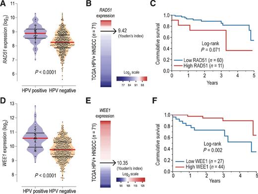 Figure 5. Higher RAD51 expression is associated with poor overall survival in patients with HPV-positive HNSCC. A, Violin plot represents RAD51 log2 transformed expression among 520 HNSCC according to HPV status. B, RAD51 gene expression range among HPV-positive HNSCC samples evaluated. C, Kaplan–Meier plot shows a trend toward worse survival rates among HPV-positive HNSCC with higher RAD51 expression. D, Violin plot represents WEE1 log2 transformed expression among 520 HNSCC according to HPV status. E, WEE1 gene expression range among HPV-positive HNSCC samples evaluated. F, Kaplan–Meier plot shows worse survival among HPV-positive HNSCC with lower WEE1 expression.