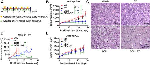 Figure 5. DT2216 increased the antitumor efficacy of gemcitabine in pancreatic cancer PDX models. A, Representation of the experimental design of the PDX studies. Tumor-bearing mice were administered Veh, DT2216 (DT), gemcitabine (GEM), or a combination of DT and gemcitabine at the indicated dosing regimen. B, Graph showing the tumor volume changes in G192-p4 PDXs in each group after the start of treatment. C, Representative H&E staining images of G192-p4 PDX tumors in each treatment group at 200 × magnification, scale bar = 50 μm. D and E, Graphs showing the tumor volume changes in G176-p4 (D) and LM12-p3 (E) PDXs in each group after the start of treatment. The data presented in (B), (D) and E are mean ± SEM (n  =  7 mice in each group at the start of treatment). Statistical significance was determined by unpaired two-sided Student t test. *, P < 0.05; **, P < 0.01; ns, not significant.