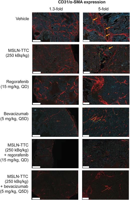 Figure 4. The expression of CD31 (green) and α-SMA (red) in images of representative ST206B ovarian PDX tumor samples 62 days after treatment. Examples of cells positive for both markers are indicated with white arrows. Scale bars 1,000 μm and 200 μm for the 1.3-fold and 5-fold magnified images, respectively.