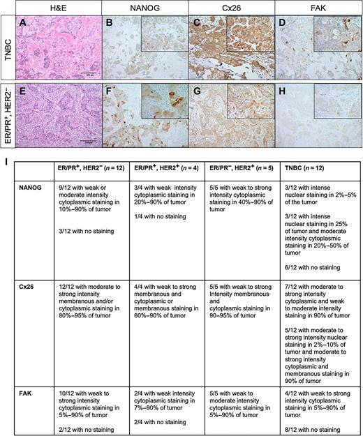 Figure 1. Cx26, NANOG, and FAK localize to intracellular compartments in TNBC tumors. A–D, TNBC assessed by sequential whole slides as stained with hematoxylin and eosin (A) showing an invasive ductal carcinoma with focal squamous differentiation, Nottingham grade 3; NANOG stain showing weak cytoplasmic expression within tumor cells (inset showing granular cytoplasmic staining in a large subset of the tumor cells; B); Cx26 stain showing intense cytoplasmic staining within a majority of the tumor cells (inset showing higher magnification; C), and FAK stain showing weak granular cytoplasmic staining within a subset of tumor cells (inset showing weak granular cytoplasmic staining and darker accentuation of staining in area of squamous differentiation; D). E–H, Estrogen/progesterone receptor (ER/PR)+/HER2− tumor assessed by sequential whole slides stained with hematoxylin and eosin (E) showing an invasive ductal carcinoma, Nottingham grade 3. F, NANOG IHC stain showing variable cytoplasmic expression within tumor cells (inset showing both weak and more intense foci of cytoplasmic staining). G, Cx26 IHC stain showing circumferential membranous expression on tumor cells (inset showing moderate to strong diffuse membrane staining) and FAK IHC stain showing very weak granular cytoplasmic staining within tumor cells (inset showing weak but diffuse granular cytoplasmic staining; H). Photomicrograph total magnification for each pane is 100×; inset total magnification is 400×. I, Summary table describing histologic findings.