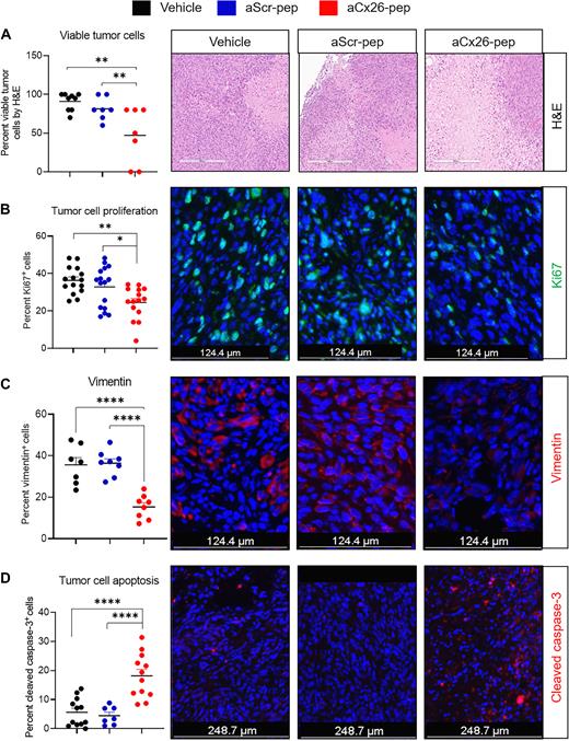 Figure 6. aCx26-pep–treated tumors show decreased tumor proliferation and cell viability and increased cell death. At endpoint, aCx26-pep–treated tumors exhibited diminished viability by H&E scoring (A), decreased Ki67 staining (B), decreased vimentin expression (C), and increased cleaved caspase-3 levels (D) compared with tumors treated with either aScr-pep or vehicle. Hematoxylin and eosin (H&E), 7–8 mice per group; immunofluorescence (IF) staining, 3–4 mice per group, 3 images per mouse. Scales bars are as denoted in each fluorescence image; for A, scale bar, 302 μm. *, P < 0.05, **, P < 0.01, ***, P < 0.001, ****, P < 0.0001 by one-way ANOVA.
