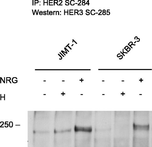 Figure 3. Western blot of HER-3 after immunoprecipitation with anti-HER-2, demonstrating HER-2/HER-3 heterodimer formation after neuregulin (NRG) stimulation. Heterodimers are detectable in JIMT-1 also constitutively and after trastuzumab (H) treatment.