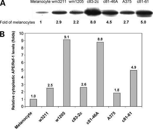 Figure 1. Increased expression of APE/Ref-1 protein in both nucleus and cytoplasm of different human melanoma cell lines compared with cultured normal melanocytes. Nuclear (A) and cytoplasmic (B) proteins were isolated from different melanoma cell lines. Protein (25 μg) was separated by SDS-PAGE, transferred onto nitrocellulose, and processed for immunoblotting with mouse anti-APE/Ref-1 antibody. All results are presented as n-fold of the expression levels in normal melanocytes and normalized by tubulin expression levels.