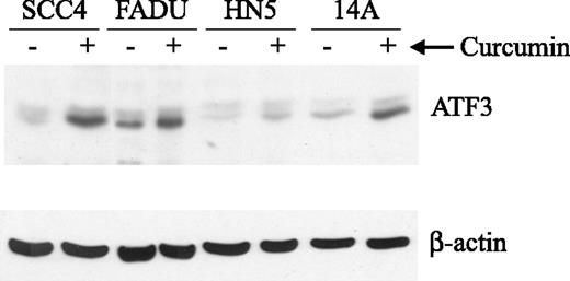 Figure 3. Curcumin increased ATF3 protein levels in various head and neck cancer cell lines. The indicated cell lines were treated with or without 50 μmol/L curcumin for 4 h and equal protein analyzed by Western blotting for ATF3 protein levels. Loading equality was checked by reprobing the blot with an anti-β-actin antibody.