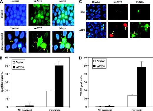 Figure 4. ATF3 accelerates the curcumin-dependent apoptosis of MDA-1986 cells. A, MDA-1986 cells were transfected with the pCG/ATF3 or empty vector. After 24 h, the cells were treated with or without 50 μmol/L curcumin for 8 h. The cells were then fixed, incubated sequentially with an anti-ATF3 antibody and an Alex 488-conjugated secondary antibody and counterstained with Hoechst 22345, and viewed for fluorescence. Apoptotic cells were identified as cells with condensed, disrupted nuclei (arrow, Hoechst staining). B, apoptotic cells in at least eight random fields or in the ATF3-positive staining population were counted. %. The percentage of apoptotic nuclei was calculated with the following formula: 100 × apoptotic cells number / total counted cell number. At least 400 apoptotic cells were counted for the ATF3-positive staining groups. C and D, MDA-1986 cells were transfected and treated as described for A. The cells were then immunostained with an ATF3 antibody and subsequently subjected to the TUNEL assay. ATF3-positive cells were visualized as red, whereas apoptotic cells were labeled green. D, apoptotic (TUNEL positive) cells were counted from either randomly selected microscopic fields, or from ATF3-positive cells (red). At least 300 ATF3-positive cells were counted.