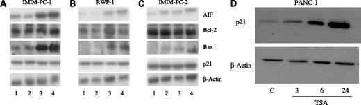 Figure 5. AIF, Bcl-2, Bax, p21, and β-actin expression levels determined by Western blot in IMIM-PC-1 (A), RWP-1 (B), and IMIM-PC-2 (C) pancreatic cancer cell lines after TSA (1 μmol/L) treatment. Lane 1, control untreated cells. Lanes 2–4, TSA-treated cells for 3, 6, and 24 h, respectively. D, p21 expression levels determined by Western blot in PANC-1 pancreatic adenocarcinoma cell line after TSA (1 μmol/L) treatment.