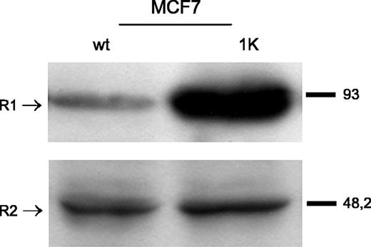 Figure 1. Expression of ribonucleotide reductase R1 and R2 in gemcitabine-resistant (1K) and sensitive (wt) MCF7 cells. Western blot analysis in MCF7 wt and MCF7 1K cells using anti–ribonucleotide reductase R1 and anti–ribonucleotide reductase R2 antibodies.