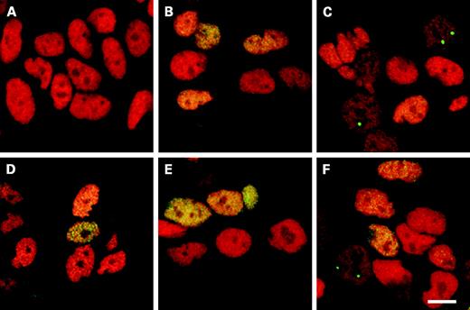 Figure 5. Immunofluorescence analysis of subcellular localization of p53. Human neuroblastoma SH-SY5Y cells were treated with 0.1 μmol/L paclitaxel (B), 1 μmol/L paclitaxel (C), 4 μmol/L CDDP (D), 4 μmol/L CDDP + 0.1 μmol/l paclitaxel (E), and 4 μmol/L CDDP + 1 μmol/L paclitaxel (F) for 24 h. Cells cultured with serum alone represented control (A). Human neuroblastoma SH-SY5Y cultures were incubated with the primary antibodies that specifically recognize p53 (FITC-conjugated secondary antibody, green) and the anti-nuclei (TRITC-conjugated secondary antibody, red) and examined using a confocal laser microscope. Bar, 8 μm.