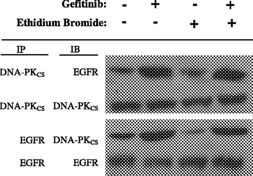Figure 4. Gefitinib-induced DNA-independent association of EGFR with DNA-PKCS in MCF-7 cells. Cells were treated with gefitinib (10 μmol/L, 24 h) and ethidium bromide (400 μg/mL, 30 min), and lysates were immunoprecipitated (IP) and immunoblotted (IB) as indicated.