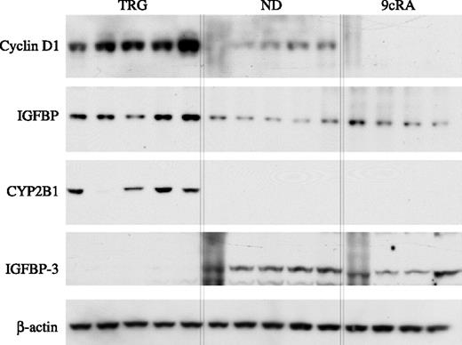 Figure 5. Immunoblotting validation on selected proteins. Microarray results were also confirmed by immunoblotting in normal liver tissues treated with targretin or 9cRA with nontreated normal liver tissue as control. Four independent samples were used for each group. Reprobing with an anti-β-actin antibody served as a control for equal loading.