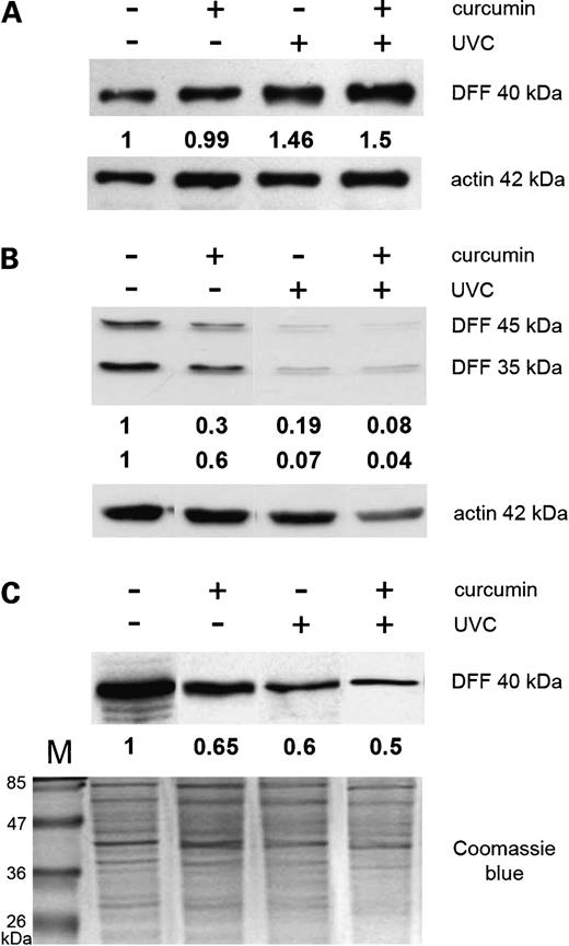 Figure 3. Content of DFF subunits in Jurkat cells 8 h after UVC irradiation, treatment with 50 μmol/L curcumin, or UVC irradiation followed by curcumin treatment. DFF40/CAD (A) and DFF45/ICAD (B) were assessed by Western blotting in whole-cell lysates. The content of DFF40/CAD was also assessed in cytoplasmic extracts (C). Quantification of data by densitometry is shown in each case.