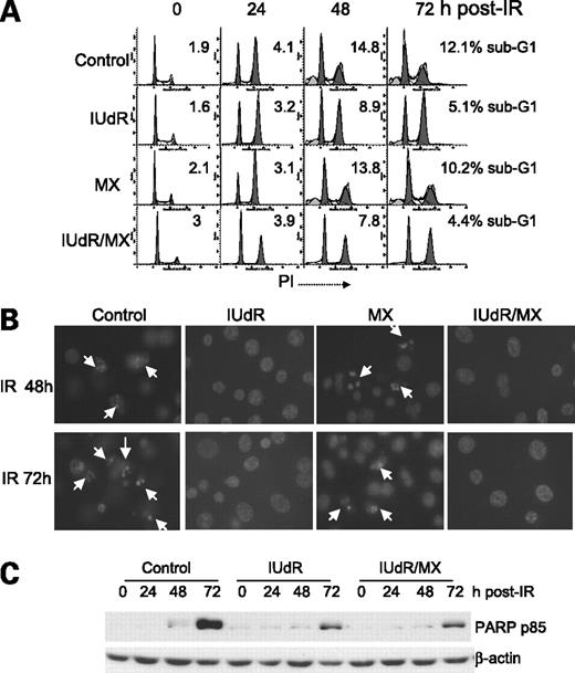 Figure 4. IUdR and IUdR/methoxyamine (MX) partially suppress ionizing radiation (IR)–induced apoptotic cell death. A, representative flow cytometry histograms of an ionizing radiation–induced sub-G1 population. B, fluorescent microscopy images with 4′,6-diamidino-2-phenylindole staining of the nucleus with condensed chromatin (arrows) in control and methoxyamine-pretreated cells. Magnification, ×400. C, Western blot of a higher level of PARP cleavage fragment p85 in control cells after ionizing radiation.