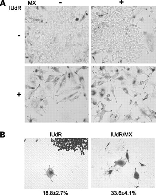 Figure 6. IUdR/methoxyamine (MX) enhances stress-induced premature senescence following ionizing radiation. A, senescence-activated β-gal staining for senescent cells at day 6 following ionizing radiation. Both IUdR- and IUdR/methoxyamine–pretreated cells are senescence-activated β-gal positive. B, quantitation of single large viable cells at day 10 after ionizing radiation. Cells are stained with crystal violet. Enlarged cell size is recognizable when compared with normal cells shown in the same picture. Magnification, ×100.