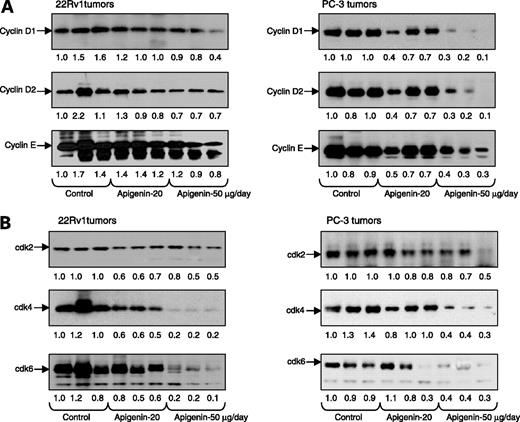 Figure 4. Effect of p.o. intake of apigenin on protein expression of (A) cyclins D1, D2, and E; and (B) cdk2, cdk4, and cdk6 in athymic nude mice implanted with 22Rv1 and PC-3 tumors. Tumors were harvested for extraction of total protein to determine the levels of these proteins by Western blotting and chemiluminescent detection. Numbers below the blots, fold modulation in the protein expression normalized to β-actin. The details are described in Materials and Methods. The blots are from three different tumors from various treated groups as indicated.