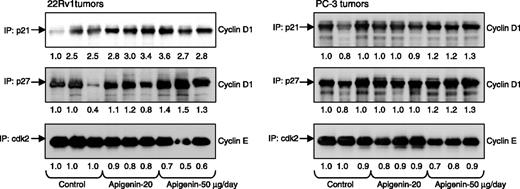 Figure 5. Effect of p.o. intake of apigenin on interbinding between WAF1/p21, KIP1/p27, and cdk2 with cyclins in athymic nude mice implanted with 22Rv1 and PC-3 tumors. Tumor lysates were prepared, 200 μg protein was immunoprecipitated and subjected to SDS-PAGE, and the binding with the other protein was determined by Western blotting directed against the other protein. Numbers below the blots, fold modulation in the protein expression normalized to β-actin. The details are described in Materials and Methods. The blots are from three different tumors from various treated groups as indicated.