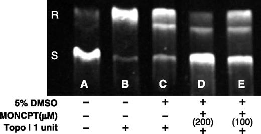 Figure 4. Effect of MONCPT on plasmid DNA relaxation induced by Topo I. Native supercoiled PBR322-DNA was incubated with Topo I in the presence of MONCPT at 200 μmol/L (lane D) and 100 μmol/L (lane E). Double-distilled water (lane B) and DMSO (solvent diluted in the same way as MONCPT, lane C) were used as negative or vehicle control, respectively. DNA without Topo I (lane A). DNA samples were separated by electrophoresis on agarose gels. Gels were then stained in ethidium bromide and photographed under UV light.