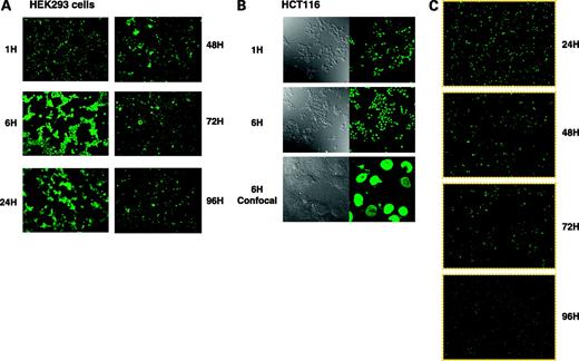 Figure 4. Incorporation of FITC-conjugated TCF decoy (18-mer). A, in HEK293 cells, almost 100% of the FITC-conjugated TCF decoy (0.1 μmol/L) was detected in the cell nuclei at 6 h after transfection. The decoy was detectable for up to 96 h. B, in HCT116 colon cancer cells, the labeled decoy (0.1 μmol/L) appeared in the cells as early as 1 h after transfection and it was detected in almost all cells at 6 h. Confocal laser microscopy clearly revealed an incorporation of decoy into nucleus. The decoy was detectable for up to 72 h.
