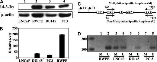 Figure 1. Analysis of 14-3-3σ expression in prostate cell lines. A, Western blot analysis. Cell lysates of LNCaP, RWPE-1, DU145, and PC3 were separated by SDS-PAGE followed by Western blot analysis of 14-3-3σ and β-actin. B, real-time reverse transcription-PCR analysis. Total RNAs from LNCaP, RWPE-1, DU145, and PC3 cells were used for real-time reverse transcription-PCR analysis as described in Materials and Methods. The 14-3-3σ level was normalized to that of LNCaP cells. C, schematic diagram illustrating primers for methylation-sensitive PCR analysis. The transcription (TC) and translation (TL) start sites were marked with arrows. M, methylation-specific amplicon. The position of CpG dinucleotides were boxed and numbered. D, methylation-sensitive PCR analysis. Methylation-sensitive PCR analysis was done as described in Materials and Methods using primers indicated in C and products were separated by agarose gel electrophoresis. U, unmethylated DNA template; M, methylated DNA template.