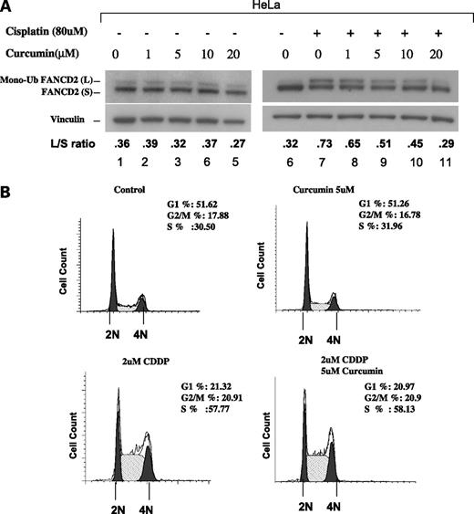 Figure 3. Curcumin inhibits FANCD2 monoubiquitination. A, Western blot analysis of FANCD2 monoubiquitination after 24-h exposure to increasing concentrations of curcumin. HeLa cells were exposed to the indicated concentrations of curcumin (lanes 1–5) or curcumin plus cisplatin (lanes 6–11). Whole cell lysates were examined by immunoblotting with the indicated FANCD2 antisera. Densitometry done using the Scion Image program 4.0.3.2 (Scion Corp., Frederick, MD) to measure the ratio of FANCD2-L/FANCD2S is shown below the blots. The blots were reprobed with vinculin as a loading control. B, cell cycle distribution analysis of propidium iodide–stained HeLa cells based on 50,000 cell counts (i) untreated, (ii) treated with 24-h exposure to 10 μmol/L curcumin alone, (iii) cisplatin (CDDP) alone, and (iv) cisplatin and curcumin combined. These profiles represent the repetition of three sets of experiments.