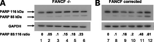 Figure 5. Curcumin synergizes with cisplatin by inducing apoptosis in an FA/BRCA intact cell line. Western blot of (A) 2008 (FANCF−/−) and (B) 2008-corrected (FANCF+/+) cells treated with curcumin and/or cisplatin for 24 h, evaluating poly(ADP)ribose polymerase (PARP) cleavage to the 85 kDa fragment (indicating apoptosis). A and B, lanes 1 and 7, untreated; lanes 2 and 8, cells with 5 μmol/L curcumin; lanes 3 and 9, 10 μmol/L curcumin; lanes 4 and 10, 80 μmol/L cisplatin; lanes 5 and 11, 80 μmol/L cisplatin and 5 μmol/L curcumin; and lanes 6 and 12, 80 μmol/L cisplatin and 10 μmol/L curcumin. Densitometry indicating the ratio of the 85 kDa protein to the 116 kDa protein is indicated below the blots. Densitometry was done using Scion Image 4.0.3.2 (Scion Corp.). The blots were reprobed for glyceraldehyde-3-phosphate dehydrogenase (GAPDH) as a loading control.