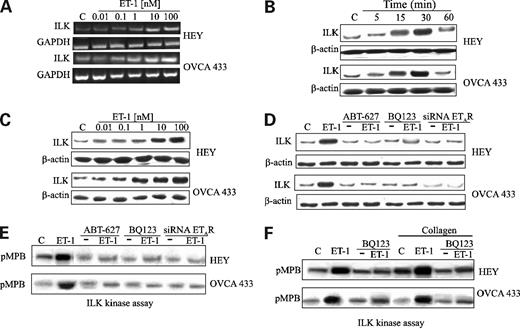 Figure 2. A, ET-1 enhances ILK mRNA transcript levels in a dose-dependent manner. Serum-starved HEY and OVCA 433 cells were treated with different concentrations of ET-1 for 30 min and subjected to reverse transcription-PCR analysis using ILK-specific primers. Primers for the amplification of the glyceraldehyde-3-phosphate dehydrogenase were used to normalize the loading of mRNA amount. B, ET-1 induces time-dependent ILK expression. Serum-starved HEY and OVCA 433 cells were incubated for different times with 100 nmol/L of ET-1. Cell lysates were immunoblotted with anti-ILK and for internal control with anti-β-actin. C, ET-1 induces dose-dependent ILK expression. Serum-starved HEY and OVCA 433 cells were incubated for 30 min with different concentrations of ET-1. Cell lysates were immunoblotted with anti-ILK and for internal control with anti-β-actin. D, ET-1 induces ILK expression through ETAR. Serum-starved HEY and OVCA 433 cells were treated with ETAR antagonists, ABT-627 or BQ 123, or transfected with ETAR siRNA in the presence or absence of ET-1. Cell lysates were immunoblotted with anti-ILK and for internal control with anti-β-actin. E, ET-1 promotes ILK activity through ETAR. Serum-starved HEY and OVCA 433 cells were treated with ETAR antagonists, ABT-627 or BQ 123, or transfected with ETAR siRNA in the presence or absence of ET-1 for 30 min. ILK activity was indicated by the amount of 32P-labeling of MBP (pMBP) of the immunoprecipitates with ILK antibodies. F, ET-1 enhances ILK activity induced by type I collagen through ETAR. Serum-starved HEY cells cultured on either regular tissue plates or type I collagen-coated plates were treated with ET-1 (100 nmol/L) in the absence or in the presence of BQ 123 (1 μmol/L) for 30 min. ILK activity was indicated by the amount of 32P-labeling of MBP (pMBP) of the immunoprecipitates with ILK antibodies.