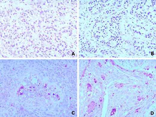 Figure 5. Representative pictures of apoptosis in untreated tumors (A), or tumors treated with oxaliplatin on days 6 and 13 (B), with NCX 4040 (C), or the two-drug combination (D).