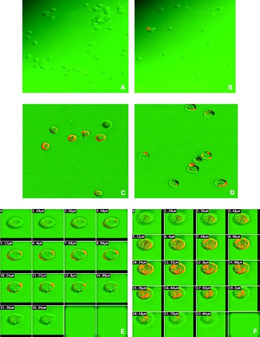 Figure 3. Confocal analysis of J6456-FR lymphoma cells exposed to folate-targeted D-FITC liposomes. Fluorescent confocal images of J6456-FR cells incubated with D-FITC liposomes containing 0.5% folate-PEG-DSPE, or with nontargeted D-FITC liposomes. Cells were incubated for 3 h with the liposome preparations, then washed and incubated in medium without liposomes for another 24 h. Cells were fixed as for the FACS analysis, washed with 1× PBS and then resuspended in 0.5 mL DABCO reagent and mounted on glass slides for observation using a Zeiss model 410 confocal microscope (488ex, 520em). A, control, 3 h of incubation; B, nontargeted D-FITC liposomes, 3 h of incubation; C, folate-targeted D-FITC liposomes, 3 h of incubation; D, folate-targeted D-FITC liposomes, 24 h of incubation; E, stepwise depth scan of folate-targeted D-FITC liposomes, 3 h of incubation; F, stepwise depth scan of folate-targeted D-FITC liposomes, 24 h of incubation.