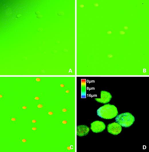 Figure 5. Confocal analysis of ascitic J6456-FR cells from the peritoneal cavity of mice after i.p. injection of nontargeted PLD or folate-targeted PLD. Experimental conditions as for Fig. 3. Samples of ascitic cells were fixed for confocal analysis and mounted on glass slides for observation using a Zeiss Model 410 confocal microscope (488ex, 520em). A, control ascitic cells; B, nontargeted PLD-exposed ascitic cells; C, folate-targeted PLD-exposed ascitic cells; D, color-coded depth scan of folate-targeted PLD-exposed ascitic cells.