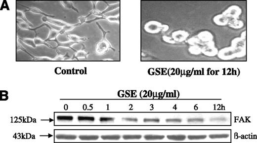 Figure 2. GSE causes anoikis and decreases FAK levels in LNCaP cells. A, cells were treated with GSE (20 μg/mL) for 12 h and cell morphology was examined under a light microscope. Magnification, ×200. B, Western blot analysis was done to determine FAK levels. Actin was used as a loading control.
