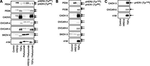 Figure 3. Effect of HRGβ1 and TGF-α on HER1 and HER2 phosphorylation in ovarian cancer cell lines. A, seven ovarian cancer cell lines were exposed (15 min) to HRGβ1 (1 nmol/L) or TGF-α (1 nmol/L) in the absence or presence of pertuzumab (100 nmol/L), and Western blots were carried out to detect relative expression levels of pHER2 (Tyr877) as described in Materials and Methods. Data were also obtained for pHER1 (Tyr845) on account of antibody cross-reactivity. B, similar data were also obtained in the same cell lines for pHER2 (Tyr1023) expression, along with the associated pHER1 (Tyr992). C, in certain cell lines, pHER1 (Tyr1045) was also present.