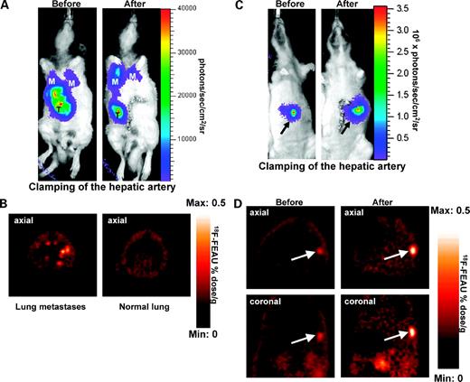 Figure 6. HRE reporter imaging prehepatic and posthepatic artery clamping. Bioluminescence images of HRE reporter–transduced Morris RH7777 hepatomas before and 6 h after transient (1 h) clamping of the hepatic artery. Note the decrease in bioluminescence signal intensity after clamping in this animal and the presence of lung metastasis (T, liver tumor; M, lung metastasis; A). The lung metastases were also visualized by [18F]FEAU microPET imaging (B). Bioluminescence images (C) and [18F]FEAU microPET images (D) of another animal bearing a reporter-transduced liver tumor before and after clamping of the hepatic artery. C and D, images from the same animal; an increase in the tumor signal after occlusion of the hepatic artery is seen in both panels (arrow, orthotopic liver tumor).